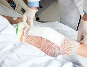 Disability Benefits of Total Knee Replacement